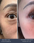BEFORE AND AFTER ONE WEEK OF USING THE CLOUD SERUM